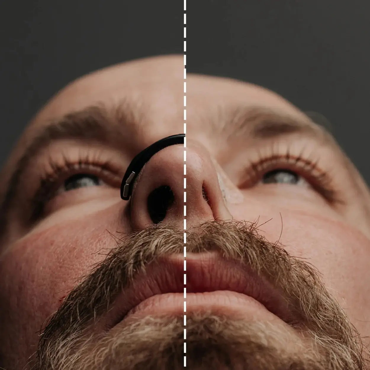 Kit Anti-Ronquidos Magnético + Adhesivos